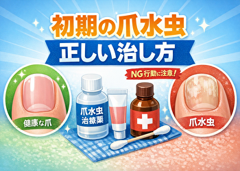 爪水虫は消毒だけで治る？初期なら自宅で治せる人・治らない人の決定的な違い