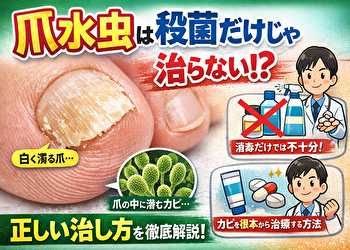 爪水虫は「消毒しても治らない」って本当？白く濁る原因と正しい治し方を徹底解説