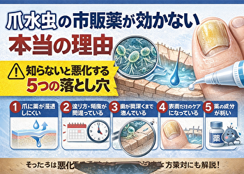 爪水虫の市販薬が効かない人の共通点｜9割が知らない“致命的な使い方”とは